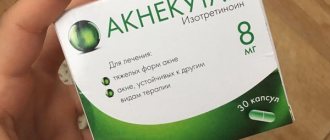 Как бороться с комплексами внешности девушке